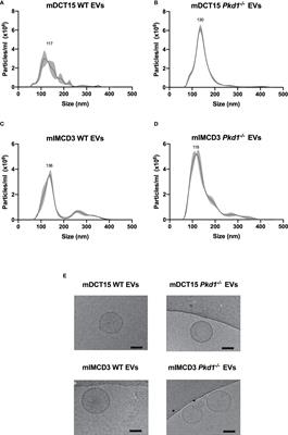 Involvement of ceramide biosynthesis in increased extracellular vesicle release in Pkd1 knock out cells